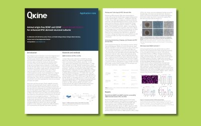 Download: Application note – Animal origin-free BDNF and GDNF neural growth factors for enhanced iPSC-derived neuronal cultures by Qkine